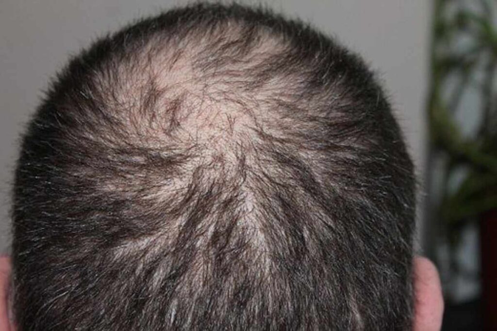 Buy finasteride online