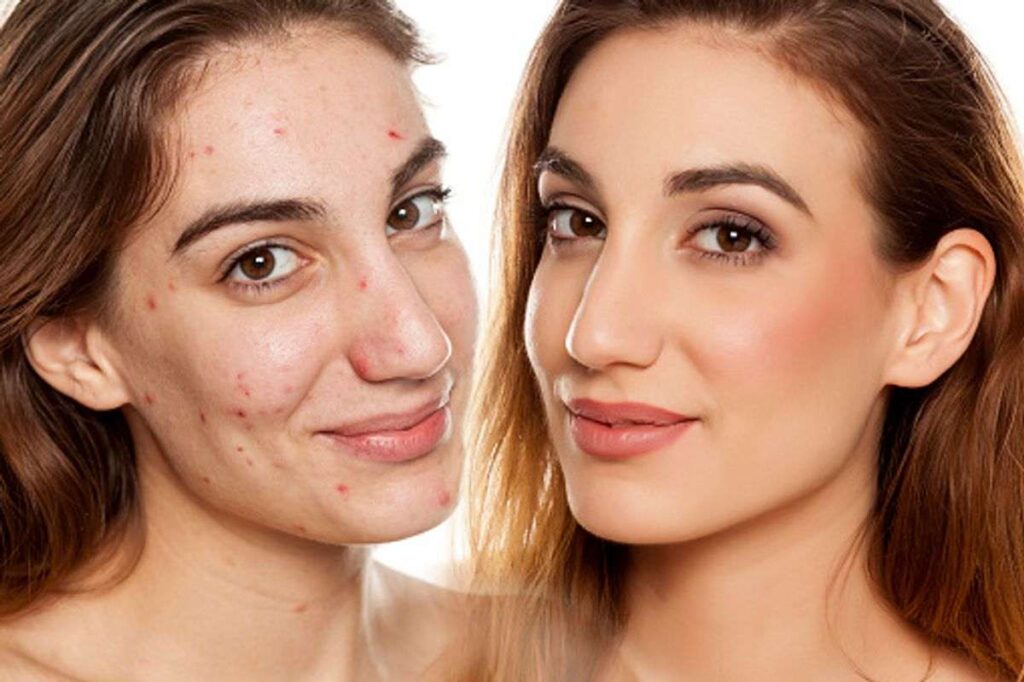 Elevare skin Reviews
