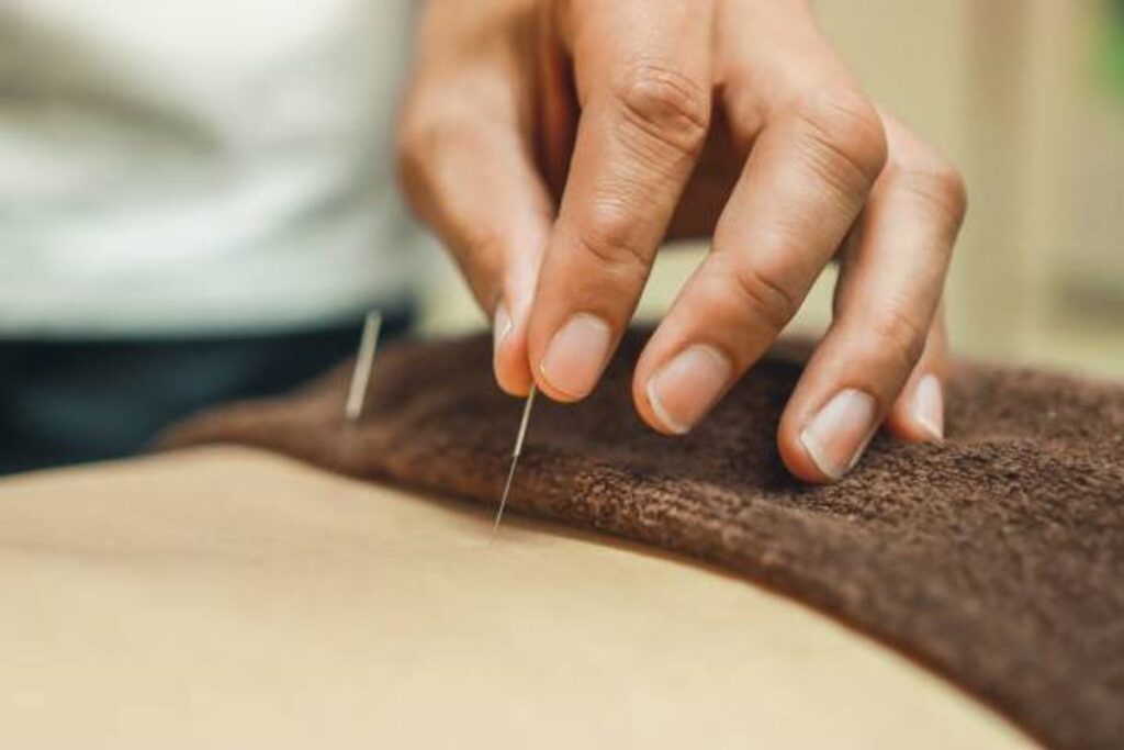 acupuncture infertility clinic near me