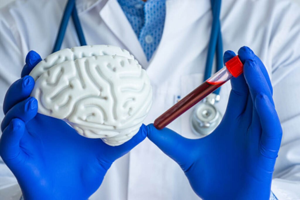 encephalopathy